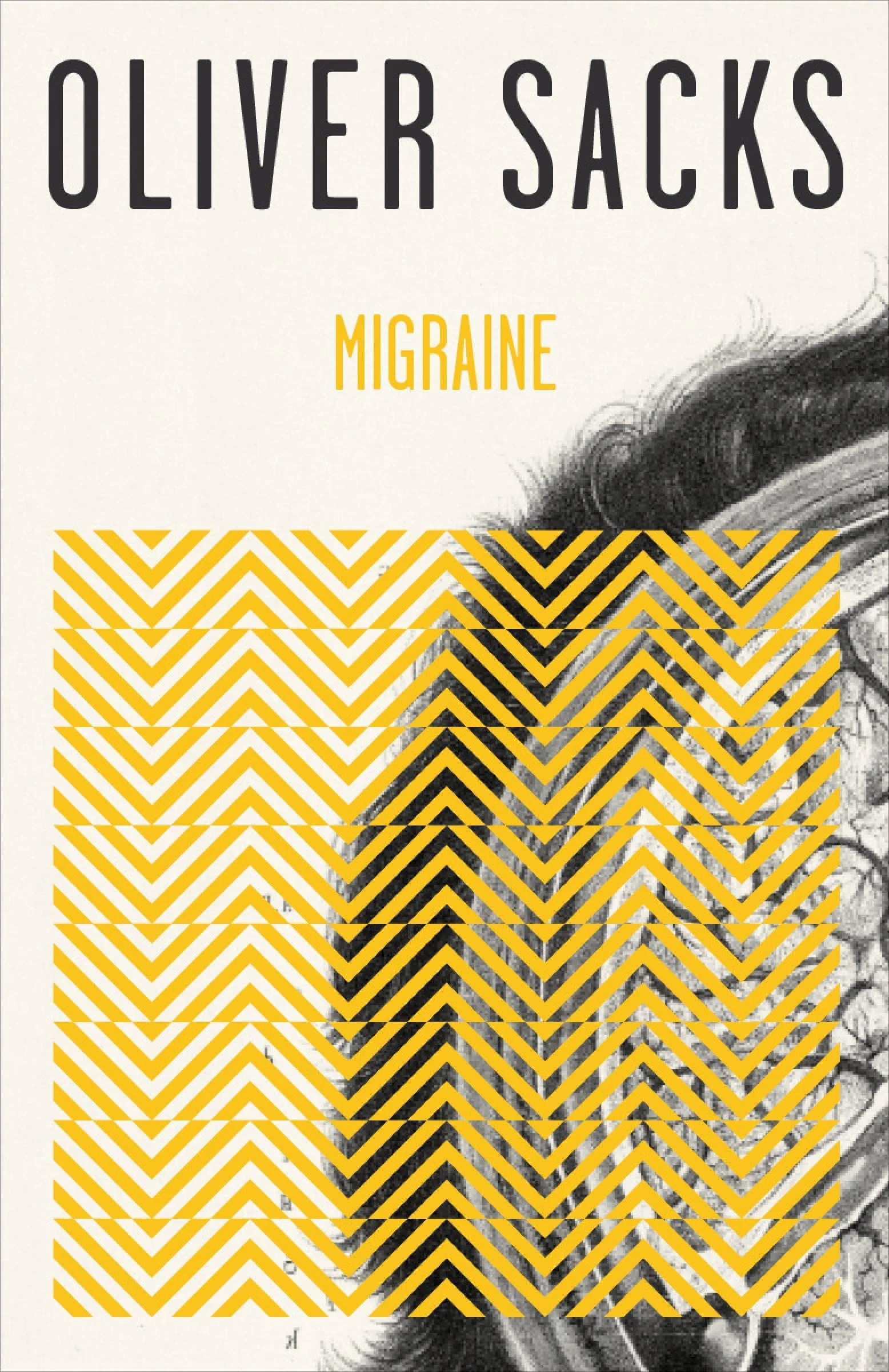 Migraine. - Image 3