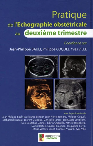 PRATIQUE DE L'ECHOGRAPHIE OBSTETRICALE AU 2EME TRIMESTRE - Image 4