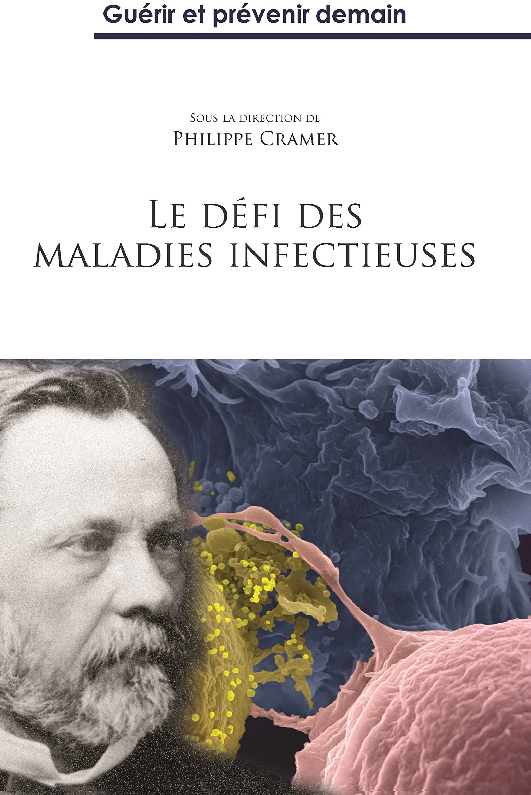 LE DÉFI DES MALADIES INFECTIEUSES - Image 2